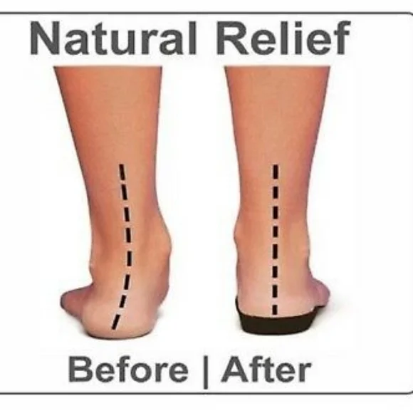 Vionic Wedge Sandals - Picture 11 of 11